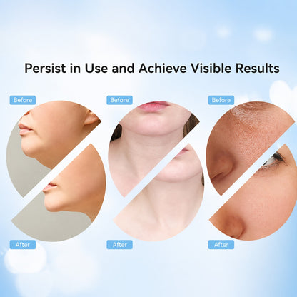 Facial Cleansing Brush – Waterproof Deep Cleansing
